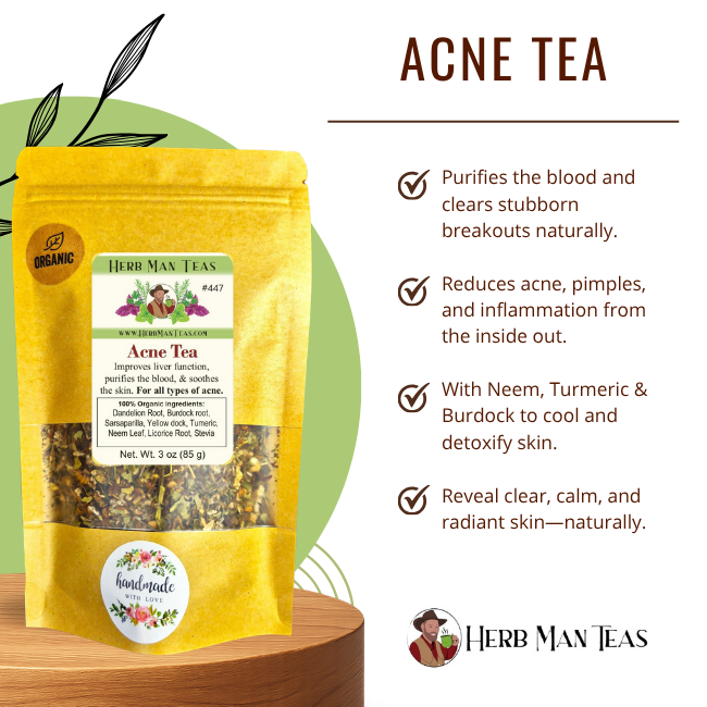ACNE TEA